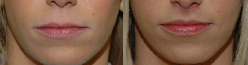 picture08.jpg picture08.jpg