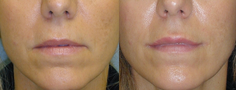 picture10.jpg picture10.jpg