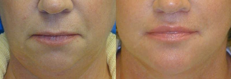 picture11.jpg picture11.jpg