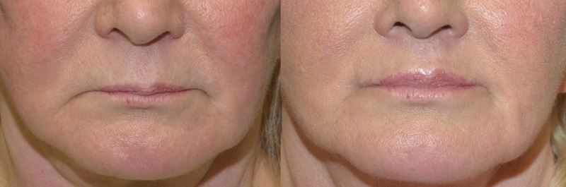 picture12.jpg picture12.jpg