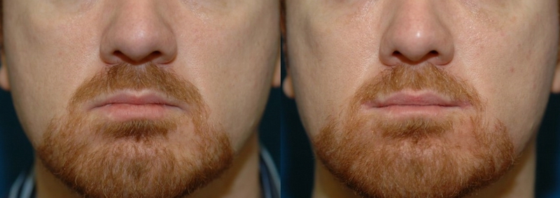 picture9.jpg picture9.jpg